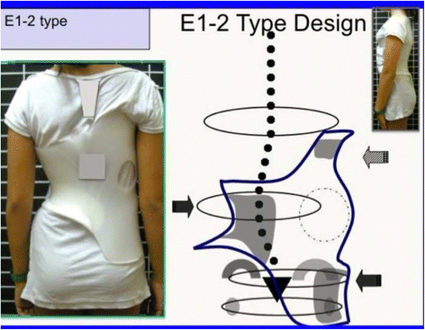 figure 51