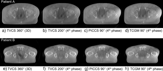 Cone-beam CT reconstruction for non-periodic organ motion using
