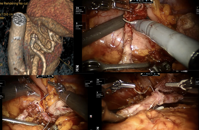 literature review xylanase figure 2