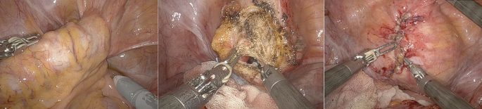 literature review xylanase figure 3