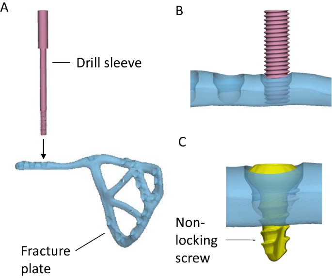 figure 9