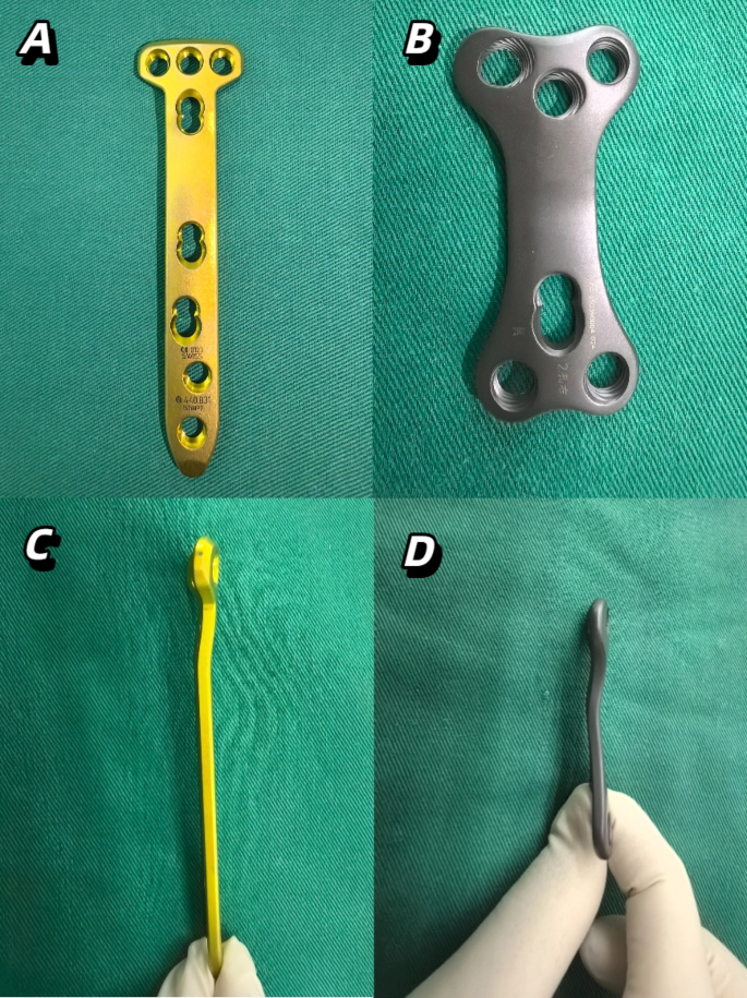 Clinical and radiographic outcomes of double-triangle locking ...