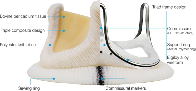 Clinical outcomes and hemodynamic performance of Dafodil™ aortic and mitral  pericardial bioprosthesis: 1-year results from Dafodil-1 first-in-human  trial | Journal of Cardiothoracic Surgery | Full Text