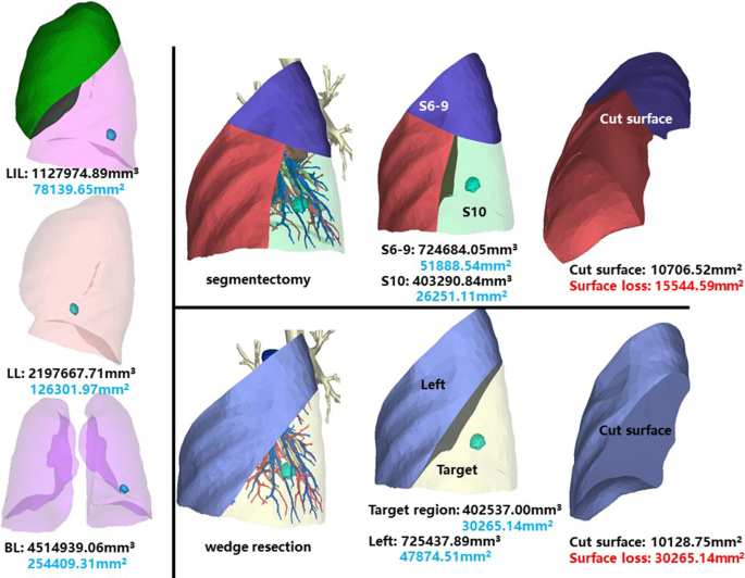 figure 17