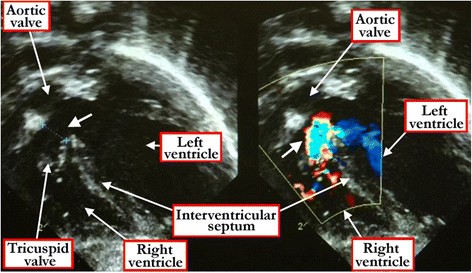 figure 14