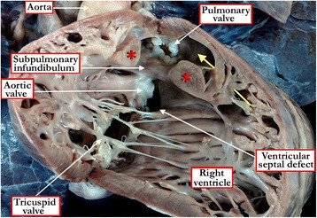 figure 18