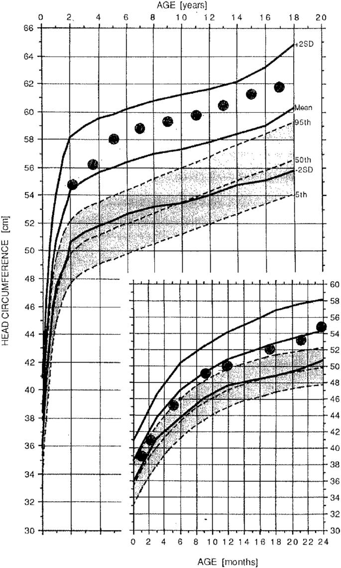 figure 31