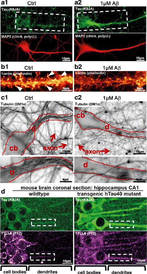 Effects of three microtubule-associated proteins (MAP2, MAP4, and Tau) on  microtubules' physical properties and neurite morphology