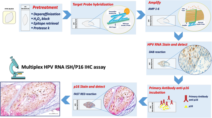 hpv lung cancer immunohistochemistry