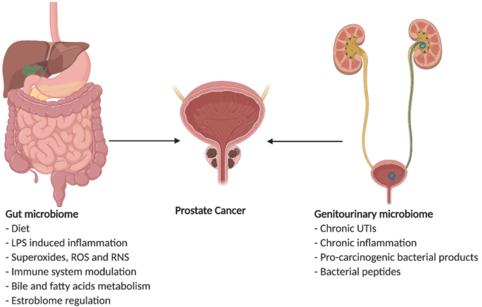 prostate cancer infection antibiotics