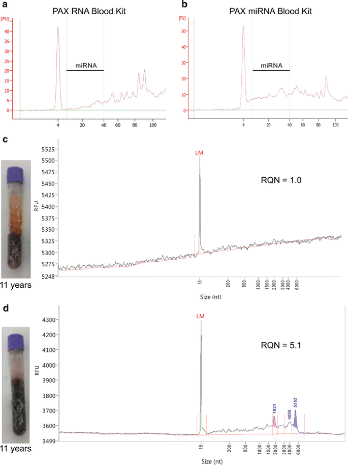 Optimized Methods For Extracting Circulating Small Rnas From Long Term Stored Equine Samples Acta Veterinaria Scandinavica Full Text