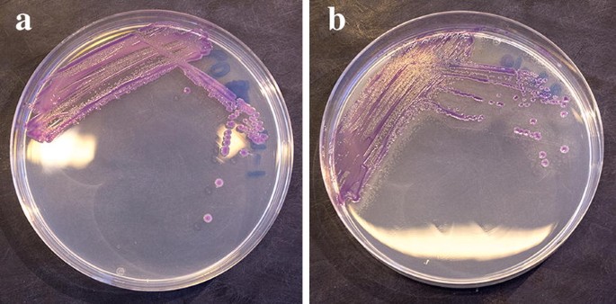 Prevalence of human pathogenic Yersinia enterocolitica in Swedish pig farms  | Acta Veterinaria Scandinavica | Full Text