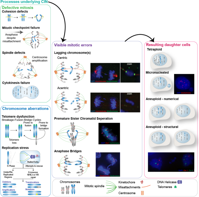 The emerging links between chromosomal instability (CIN), metastasis,  inflammation and tumour immunity | Molecular Cytogenetics | Full Text