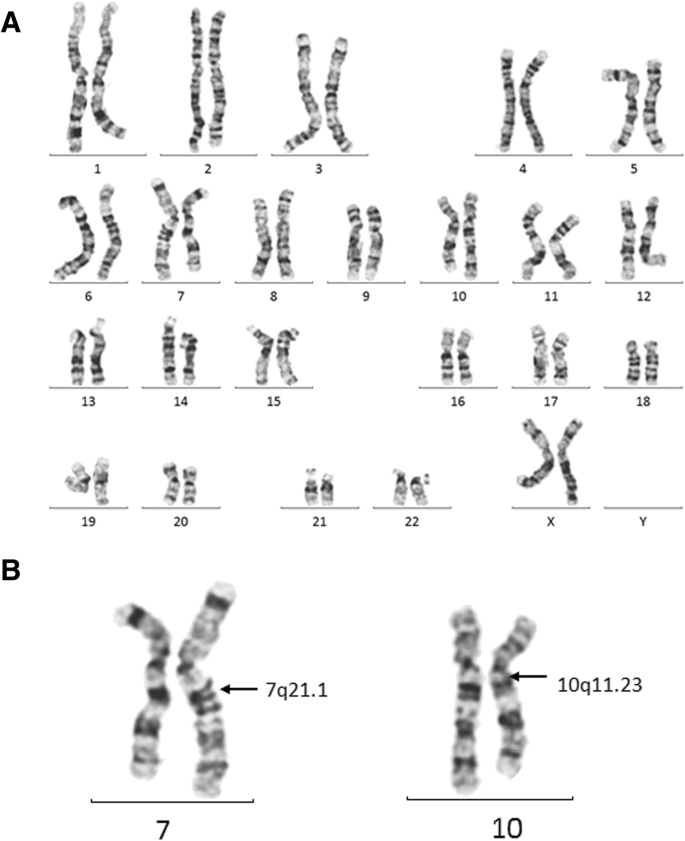 Detection Of A Balanced Translocation Carrier Through Trophectoderm Biopsy Analysis A Case Report Molecular Cytogenetics Full Text