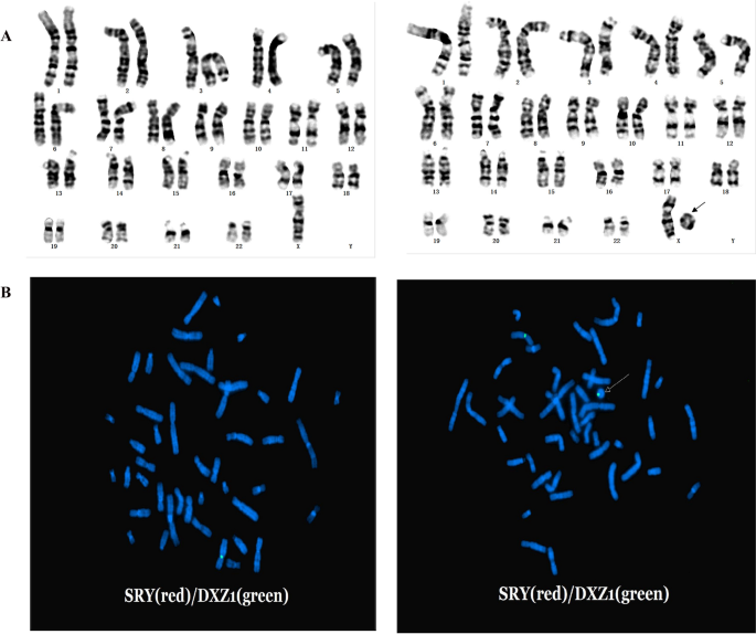 Chromosomal Abnormalities - ppt download