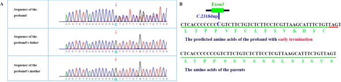 Expanding the phenotype associated to KMT2A variants: overlapping clinical  signs between Wiedemann–Steiner and Rubinstein–Taybi syndromes