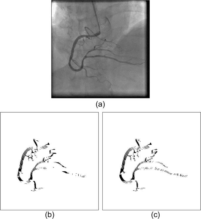 figure 15