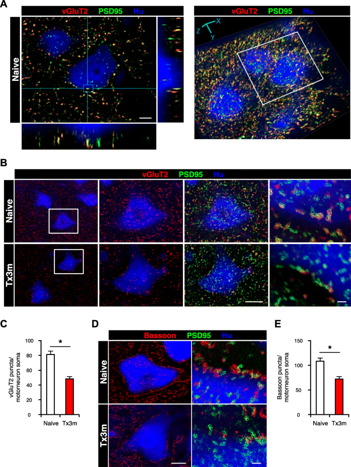 Pathological Changes Of Distal Motor Neurons After Complete Spinal Cord Injury Springerlink Pathological Changes Of Distal Motor Neurons After Complete Spinal Cord Injury Springerlink