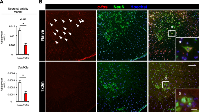 Pathological Changes Of Distal Motor Neurons After Complete Spinal Cord Injury Springerlink Pathological Changes Of Distal Motor Neurons After Complete Spinal Cord Injury Springerlink