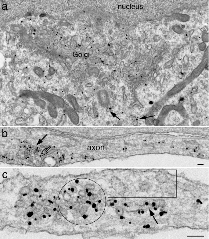 A high magnification image of synapse obtained by electron microscopy