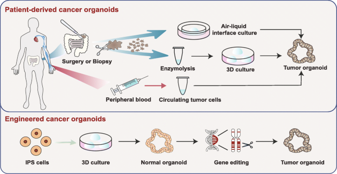Organoid Culture of Isolated Cells from Patient-derived Tissues with Colorectal Cancer.