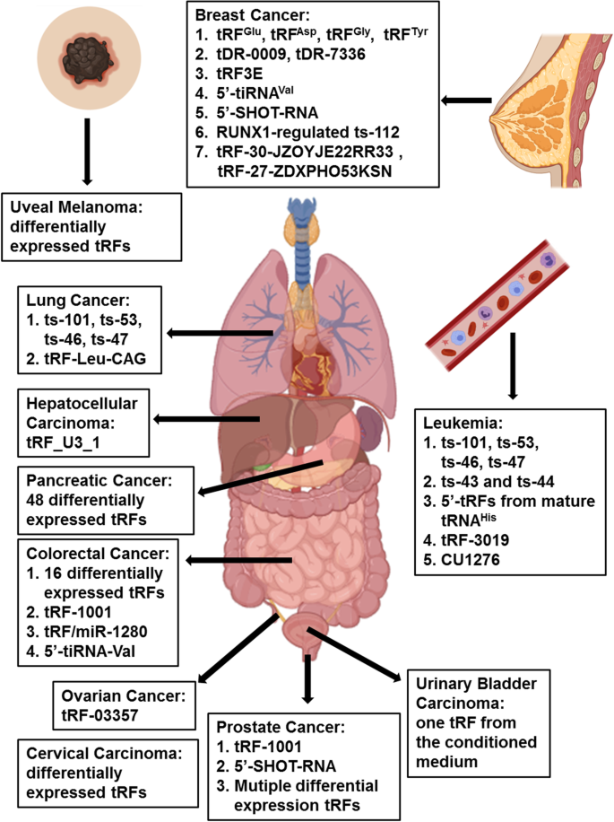 tRNA modifications: insights into their role in human cancers: Trends in  Cell Biology