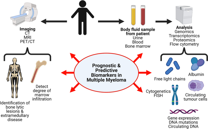 Prognostic and predictive biomarker developments in multiple myeloma |  Journal of Hematology & Oncology | Full Text