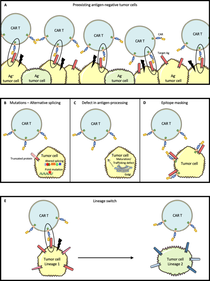 Born to survive: how cancer cells resist CAR T cell therapy | Journal of  Hematology & Oncology | Full Text