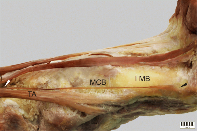 A cadaveric and sonographic study of the morphology of the tibialis anterior  tendon – a proposal for a new classification | Journal of Foot and Ankle  Research | Full Text