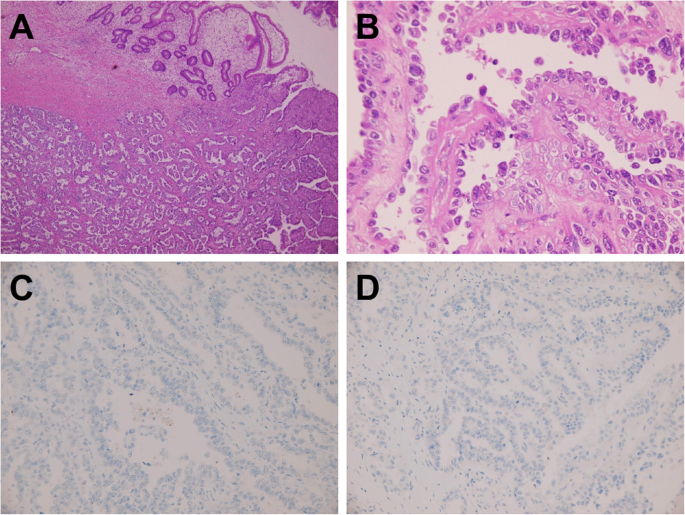 figure1