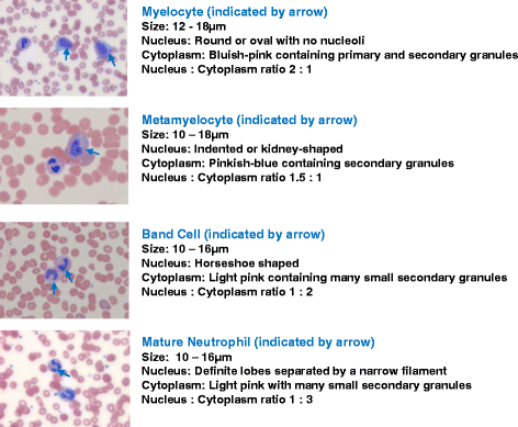 myelocyte and metamyelocyte