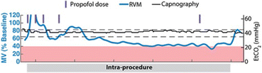 figure 36