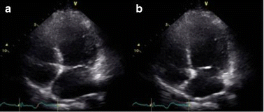 figure 42