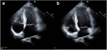 figure 43