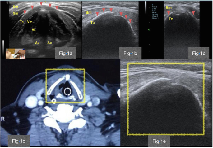 figure 162