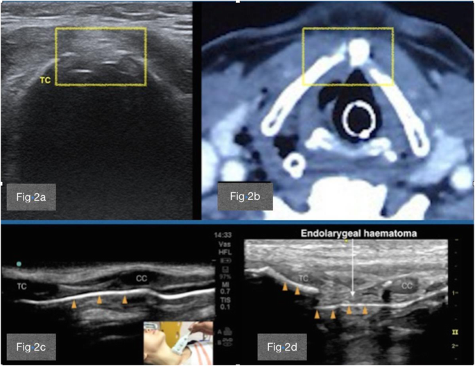 figure 163