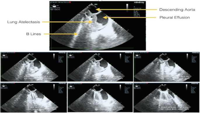 figure 168