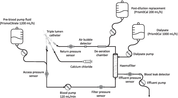 How I prescribe continuous renal replacement therapy | Critical Care | Full  Text