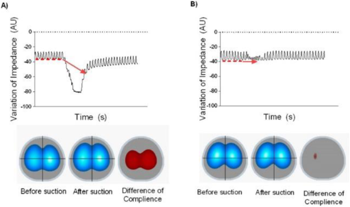 figure 37