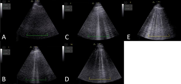 figure1