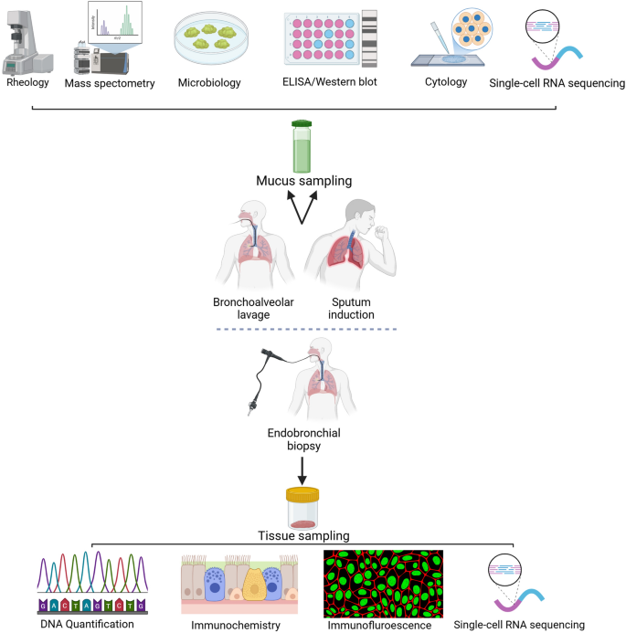 glutathione mucus Physiology and pathophysiology of mucus and mucolytic use in critically ill  patients | Critical Care