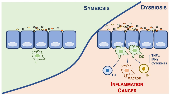 dysbiosis baba