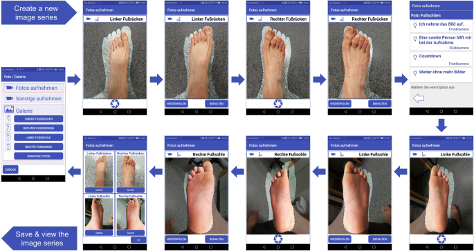 wallpapers Early Stage Diabetic Leg Ulcers Pictures diabetic foot ulceration
