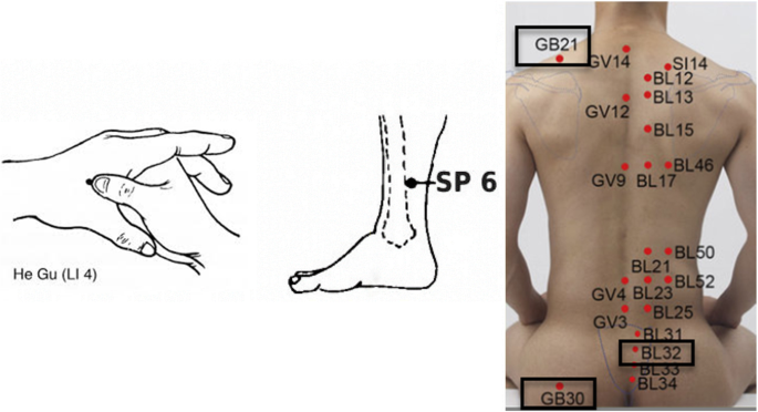 Comparing The Effect Of Auricular Acupressure And Body Acupressure On Pain And Duration Of The First Stage Of Labor Study Protocol For A Randomized Controlled Trial Trials Full Text