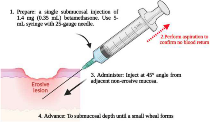 vitamin b12 injection how to administer How to Give B12 Injections at Home to Yourself · PA Relief vitamin b12 injection how to administer How to Give B12 Injections at Home to Yourself · PA Relief
