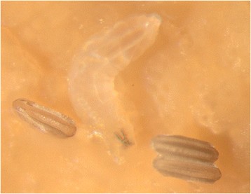 gyógyszer emberi paraziták megelőzésére amit a pinwormok nem tudnak elviselni