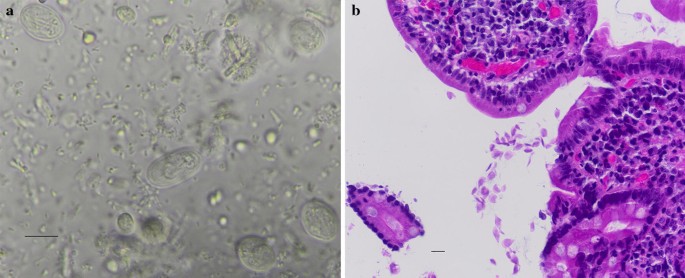 papilloma vírus meghatározása egyszerű képek a helmintférgekről