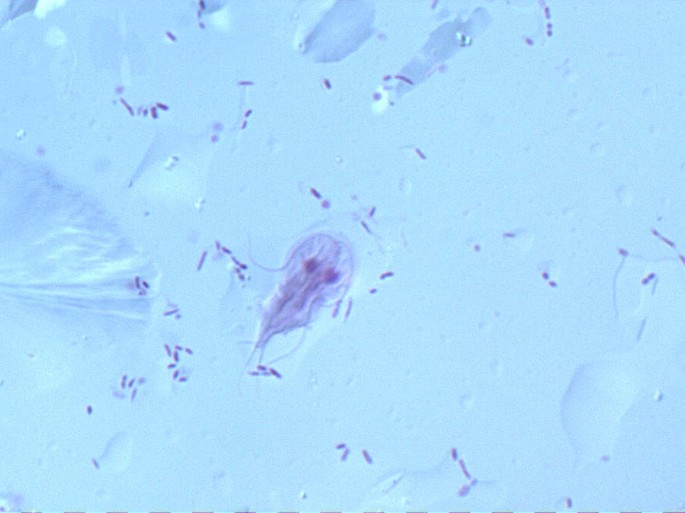 giardia parasite uk