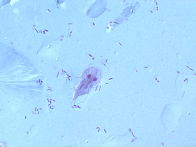 giardiasis uk)