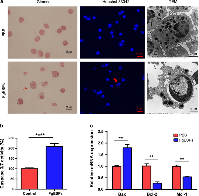 Fasciola gigantica excretory-secretory products (FgESPs) modulate the  differentiation and immune functions of buffalo dendritic cells through a  mechanism involving DNMT1 and TET1 | Parasites & Vectors | Full Text